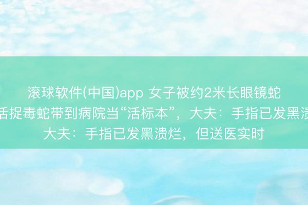 滚球软件(中国)app 女子被约2米长眼镜蛇咬伤手指，单手活捉毒蛇带到病院当“活标本”，大夫：手指已发黑溃烂，但送医实时